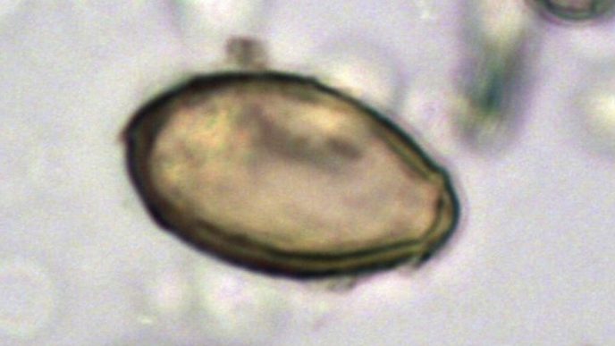 o-persoana-din-sua-a-murit-de-ciuma-pneumonica