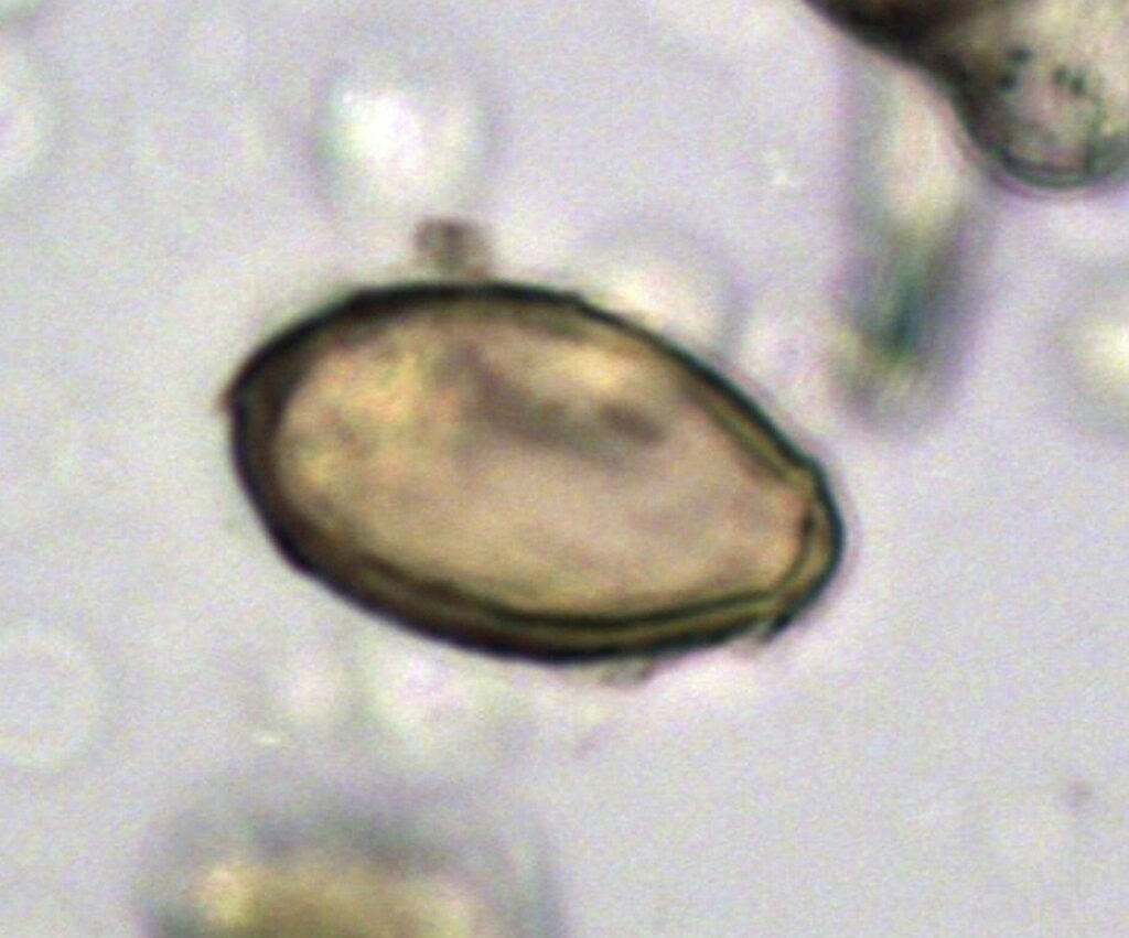 o-persoana-din-sua-a-murit-de-ciuma-pneumonica